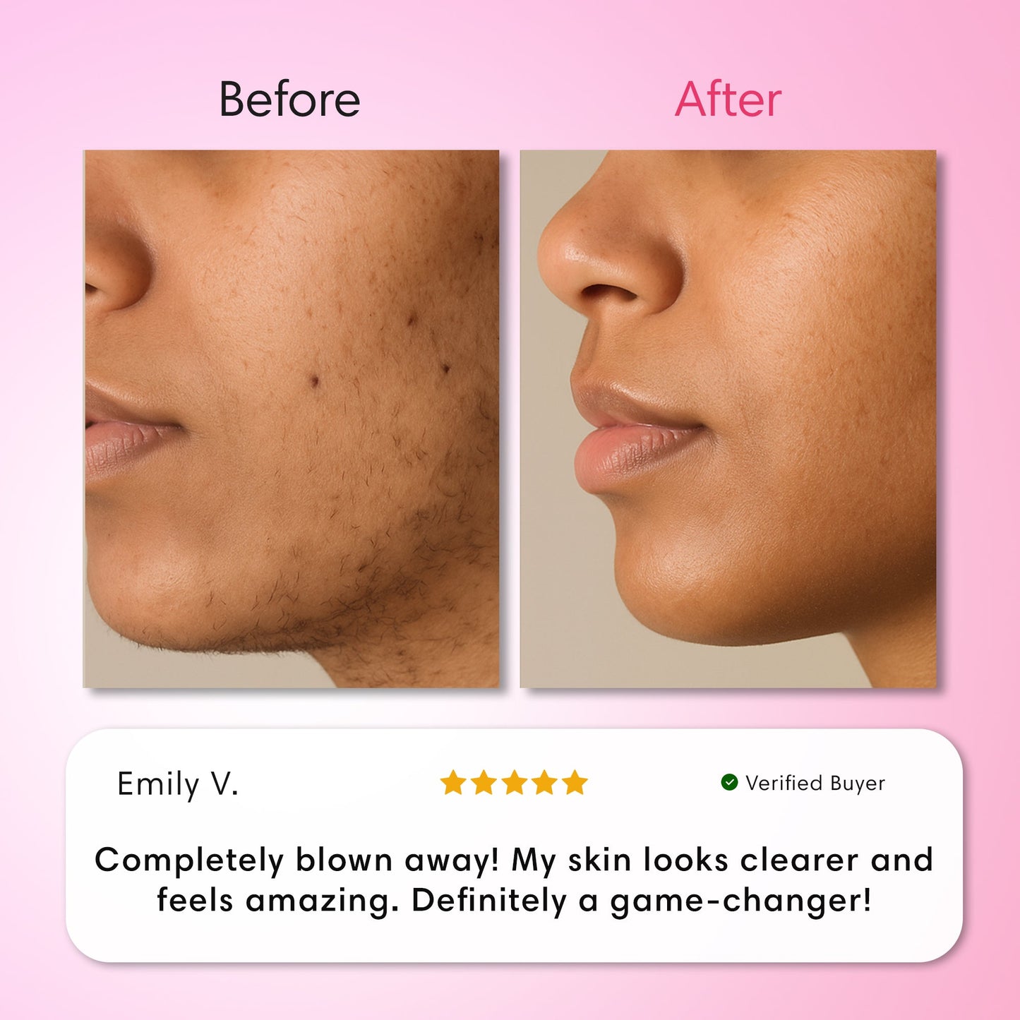 Stop the Cycle of Unwanted Hair Regrowth ✨ Smooth Skin Made Simple （Hair Removal Trilogy Kit）