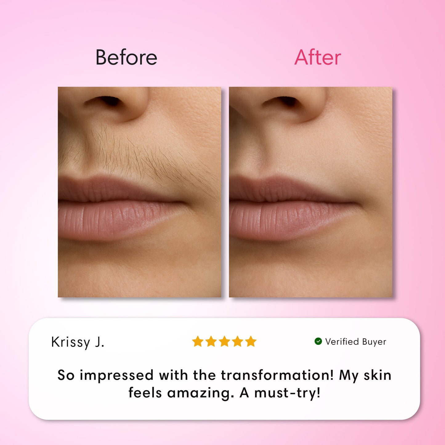 Stop the Cycle of Unwanted Hair Regrowth ✨ Smooth Skin Made Simple （Hair Removal Trilogy Kit）