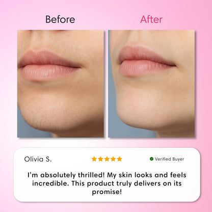 Stop the Cycle of Unwanted Hair Regrowth ✨ Smooth Skin Made Simple （Hair Removal Trilogy Kit）