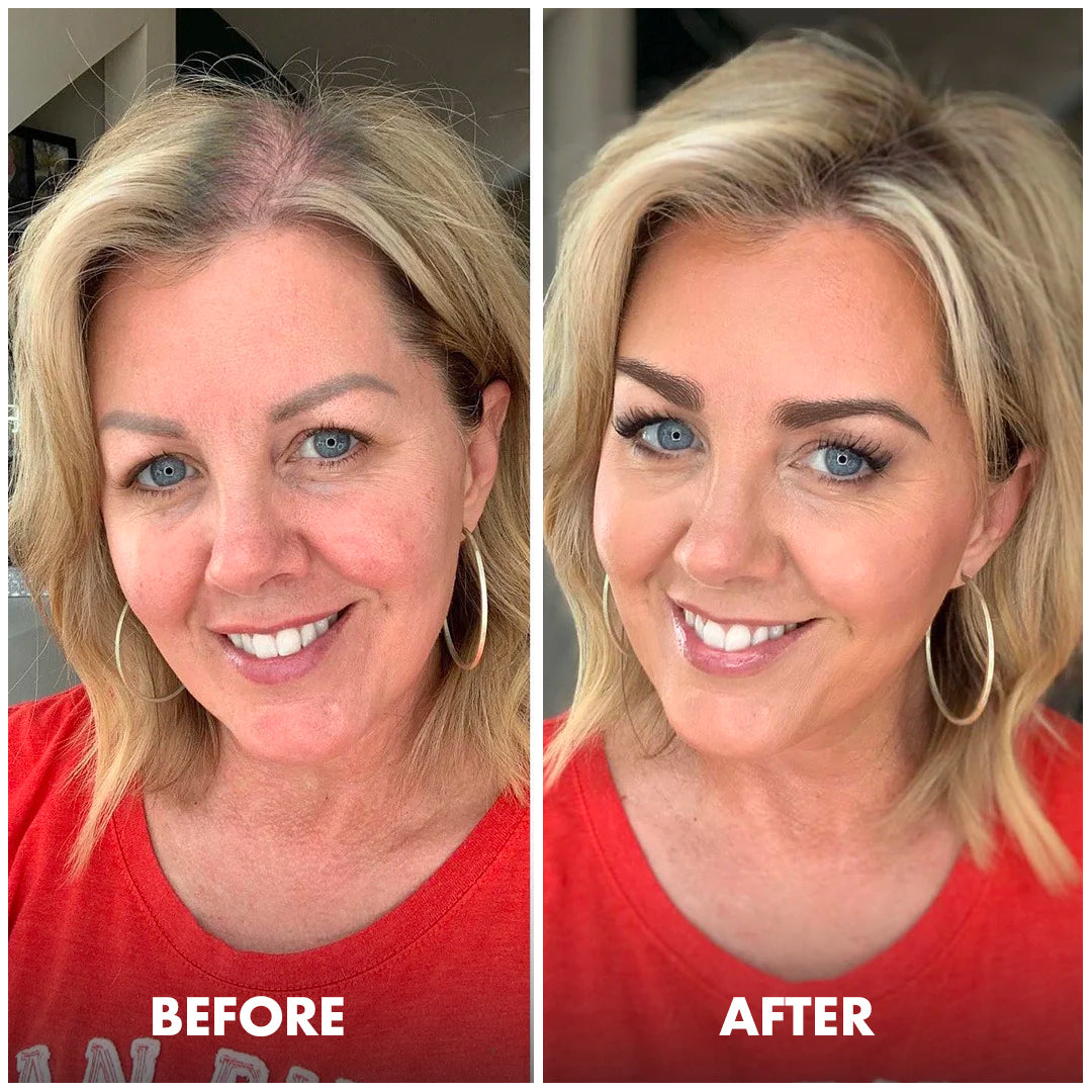 LUMIVO™ Hair Growth Spray 🌿 | Thicker, Stronger, Fuller Hair